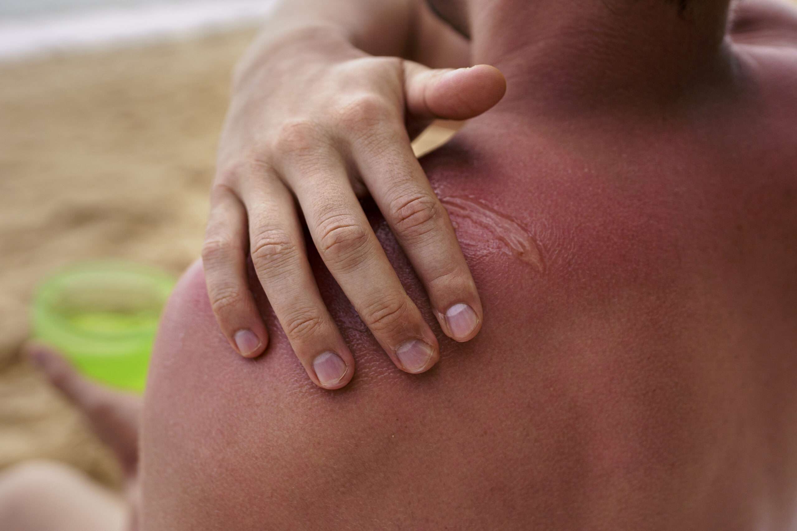 Skin Care Tips for Summer