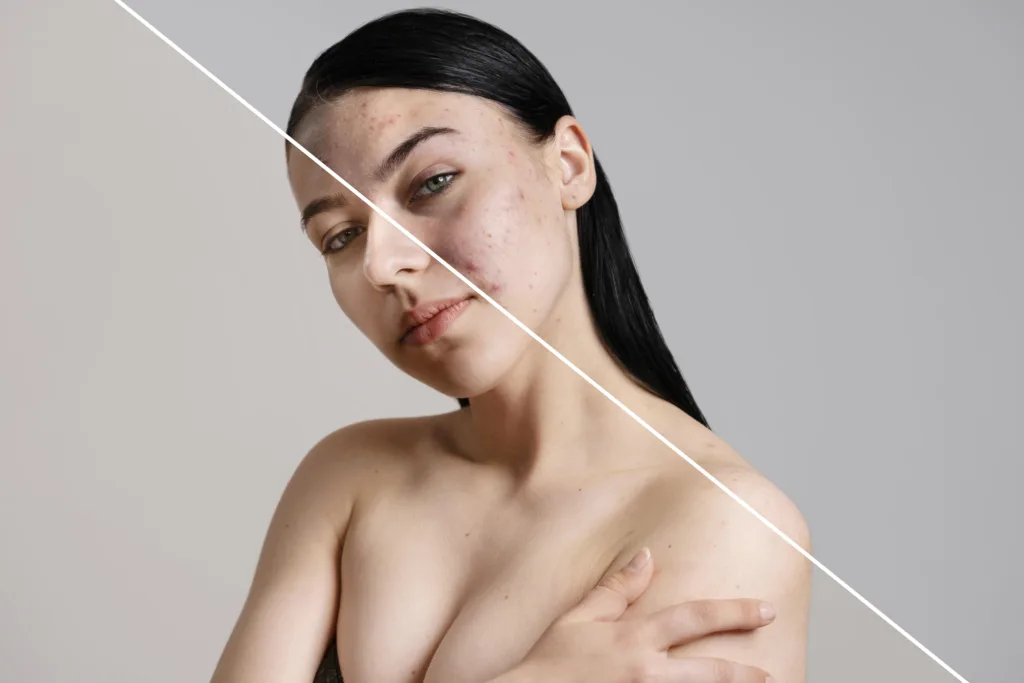 Before and after skincare results, discussing What Does Dry Skin Say About Your Health.